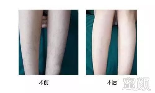 https://img.miyanlife.com/mnt/timg/181231/09560Q5F-4.jpg