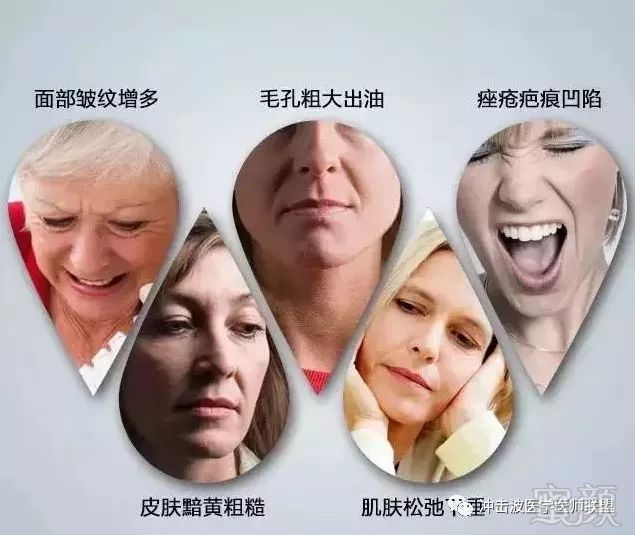 https://img.miyanlife.com/mnt/timg/181231/1059211394-2.jpg