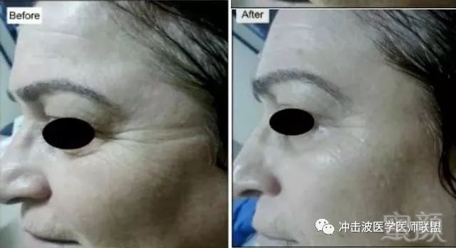 https://img.miyanlife.com/mnt/timg/181231/10592145E-3.jpg
