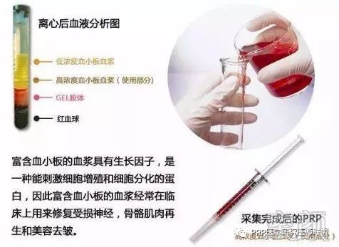 https://img.miyanlife.com/mnt/timg/181231/1059221221-6.jpg