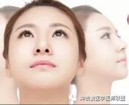 https://img.miyanlife.com/mnt/timg/181231/1059223a5-4.jpg