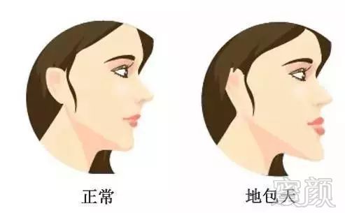 https://img.miyanlife.com/mnt/timg/181231/1104202Y9-1.jpg