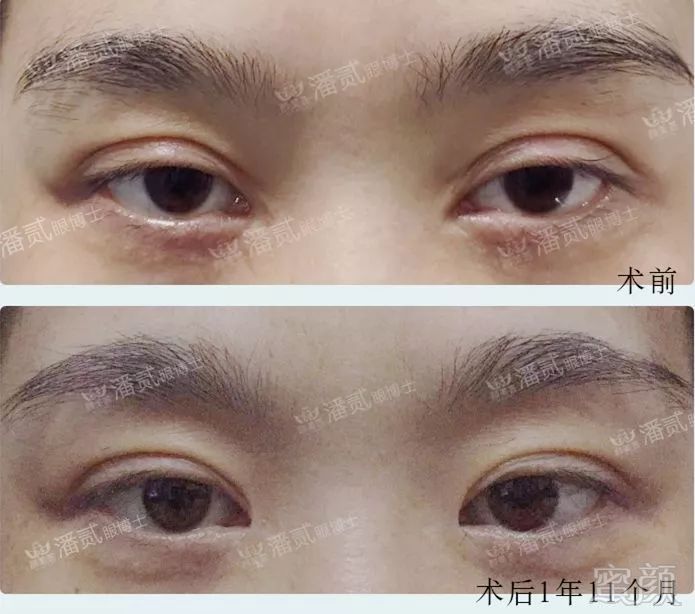 https://img.miyanlife.com/mnt/timg/190101/1146162027-2.jpg