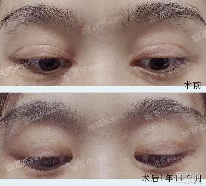 https://img.miyanlife.com/mnt/timg/190101/11461634W-4.jpg