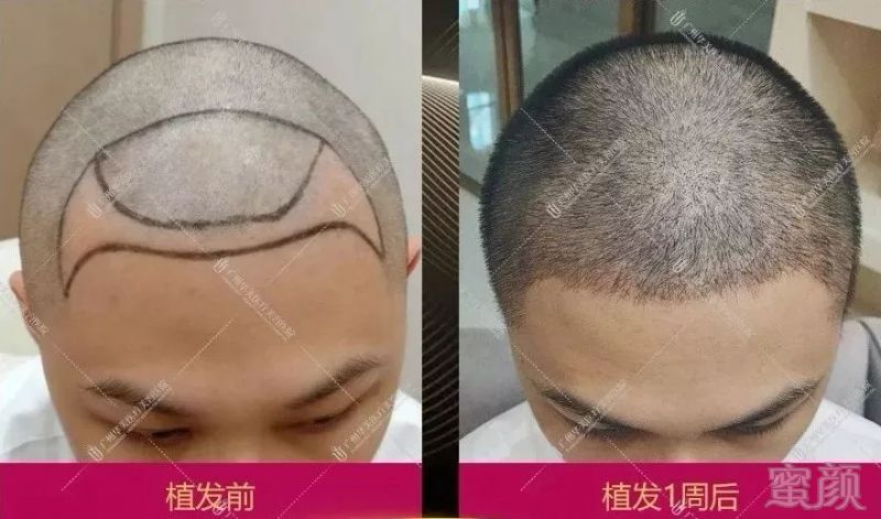 https://img.miyanlife.com/mnt/timg/190101/1256101543-4.jpg