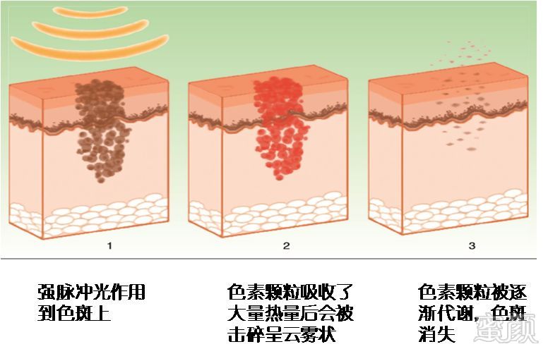 https://img.miyanlife.com/mnt/timg/190101/125Z9C63-2.jpg