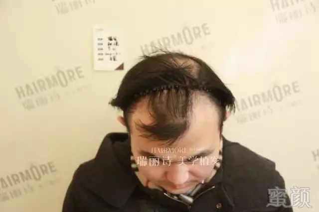 https://img.miyanlife.com/mnt/timg/190102/11224IW0-0.jpg