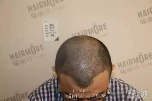 https://img.miyanlife.com/mnt/timg/190102/11224J922-2.jpg