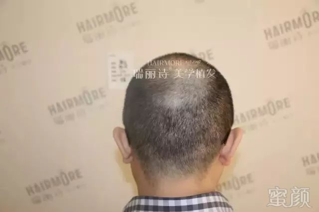 https://img.miyanlife.com/mnt/timg/190102/11224MU2-3.jpg