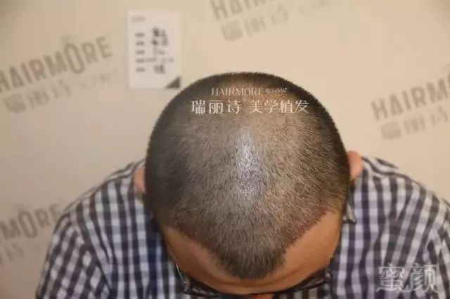 https://img.miyanlife.com/mnt/timg/190102/11224W5H-4.jpg
