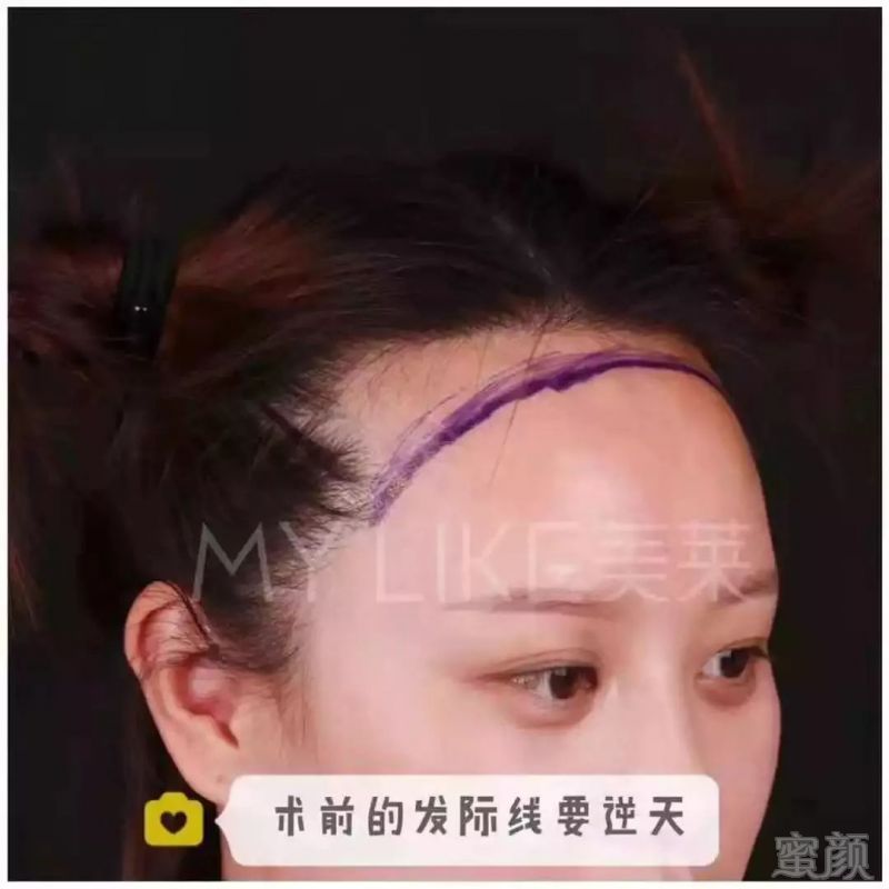 https://img.miyanlife.com/mnt/timg/190102/1124145S1-2.jpg