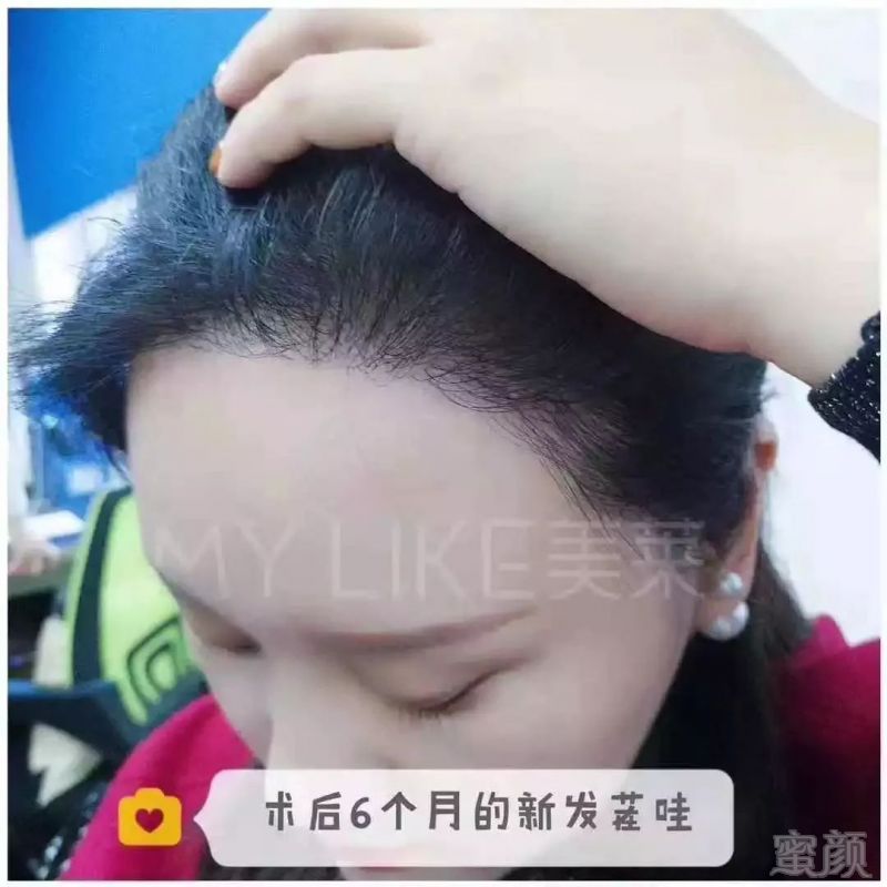 https://img.miyanlife.com/mnt/timg/190102/11241522H-4.jpg