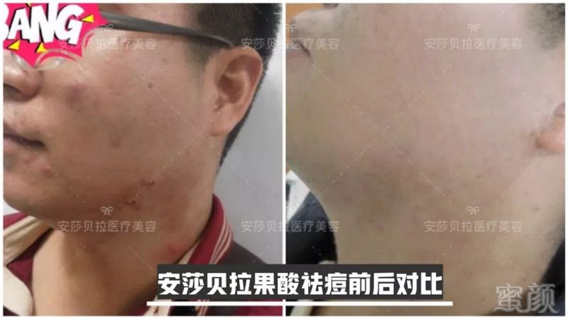 https://img.miyanlife.com/mnt/timg/190102/121521C31-2.jpg