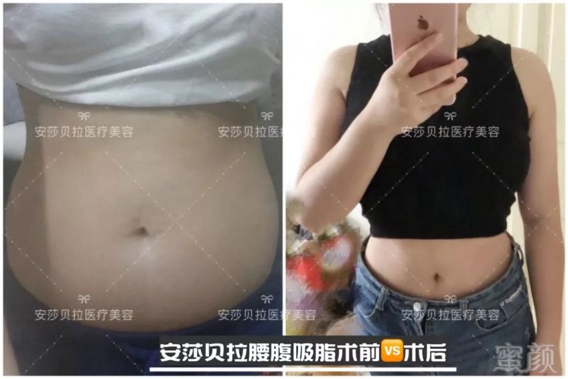 https://img.miyanlife.com/mnt/timg/190102/12152351c-4.jpg