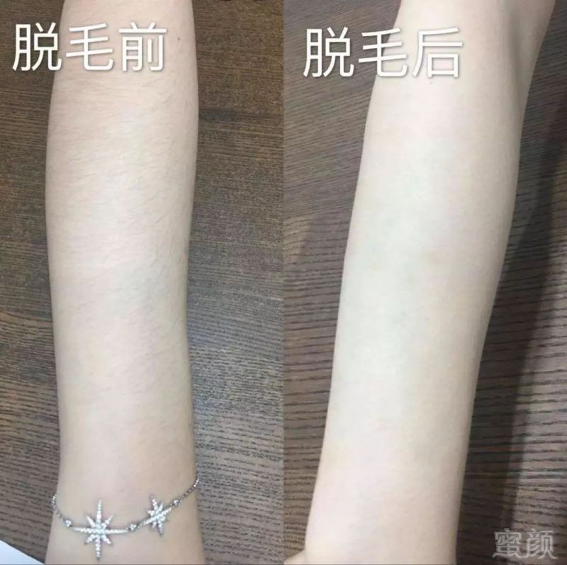 https://img.miyanlife.com/mnt/timg/190102/121523M19-5.jpg