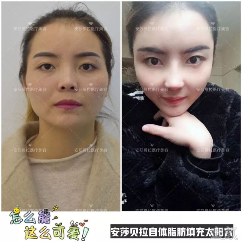 https://img.miyanlife.com/mnt/timg/190102/1215245357-8.jpg