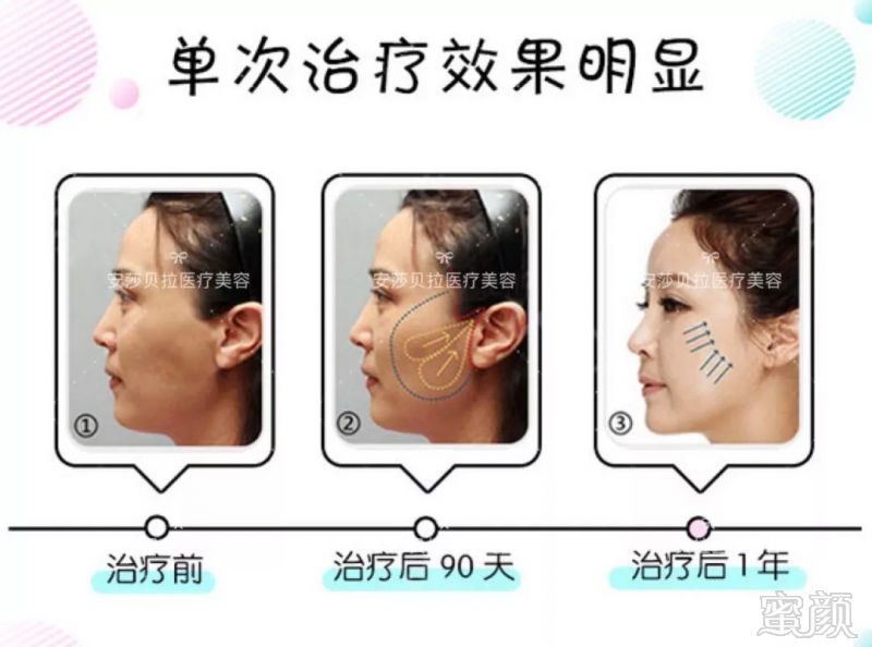 https://img.miyanlife.com/mnt/timg/190102/121524G26-9.jpg
