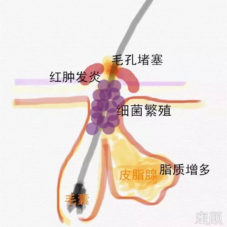 https://img.miyanlife.com/mnt/timg/190102/1229253A1-1.jpg