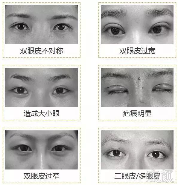 https://img.miyanlife.com/mnt/timg/190102/1231525561-15.jpg