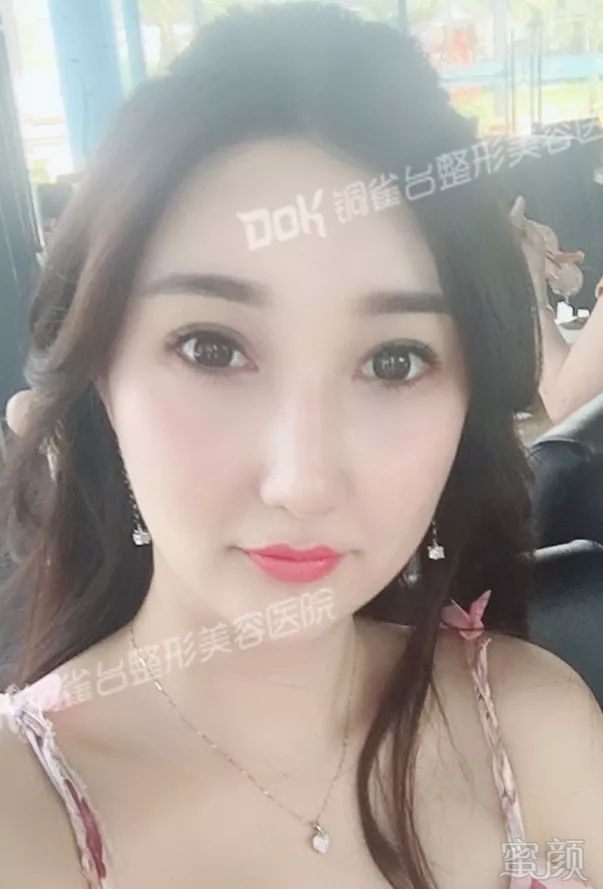 https://img.miyanlife.com/mnt/timg/190102/12323a542-7.jpg