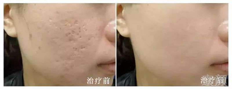 https://img.miyanlife.com/mnt/timg/190102/1232412240-11.jpg