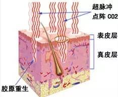 https://img.miyanlife.com/mnt/timg/190102/1232415Y7-9.jpg