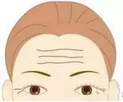 https://img.miyanlife.com/mnt/timg/190103/1136225G2-2.jpg