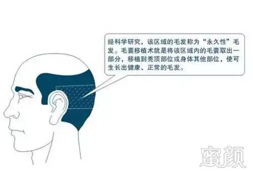 https://img.miyanlife.com/mnt/timg/190103/11424332R-2.jpg