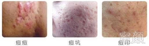 https://img.miyanlife.com/mnt/timg/190103/1143303235-2.jpg