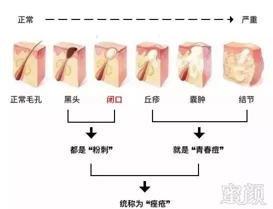https://img.miyanlife.com/mnt/timg/190103/1150292959-2.jpg