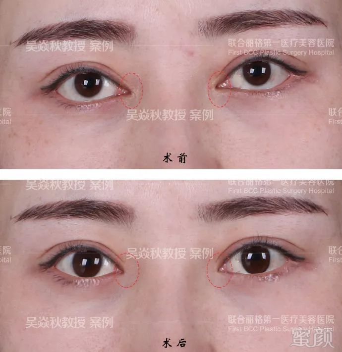 https://img.miyanlife.com/mnt/timg/190103/1211493454-3.jpg