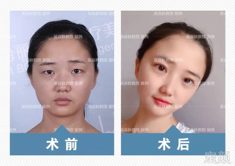 https://img.miyanlife.com/mnt/timg/190103/12114UZ9-0.jpg
