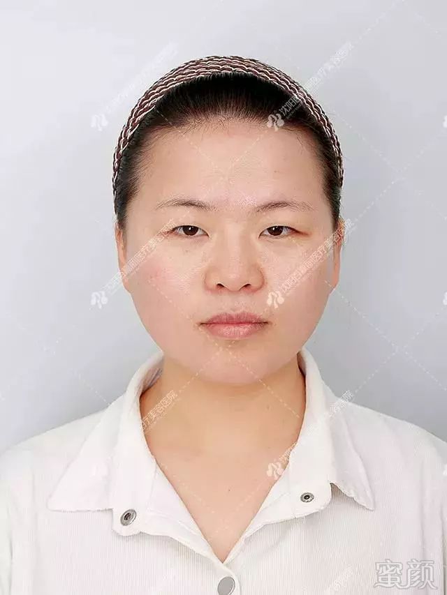 https://img.miyanlife.com/mnt/timg/190103/1250061H0-0.jpg