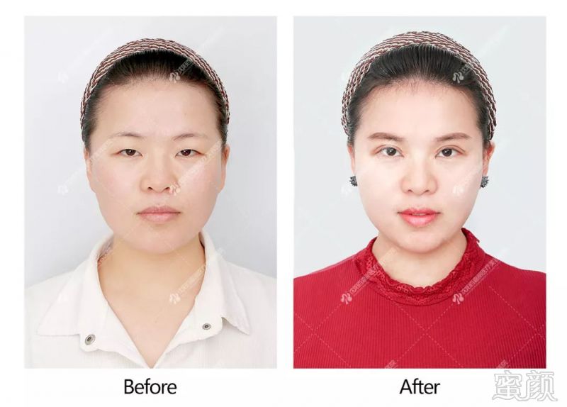 https://img.miyanlife.com/mnt/timg/190103/12500QS1-10.jpg
