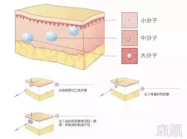 案例图片