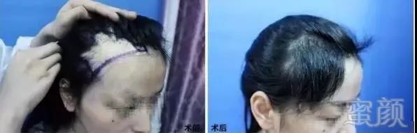https://img.miyanlife.com/mnt/timg/190104/12294H019-3.jpg