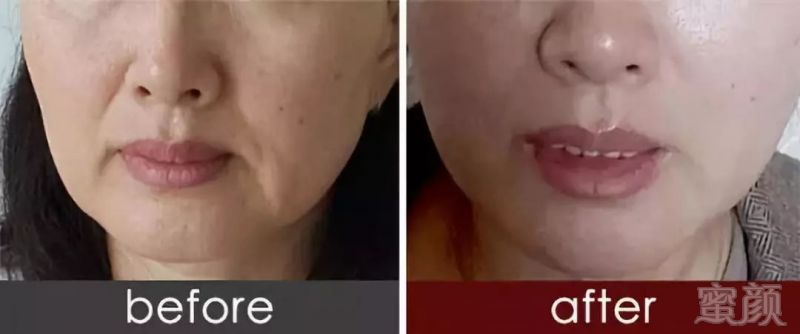https://img.miyanlife.com/mnt/timg/190104/130Q22213-5.jpg