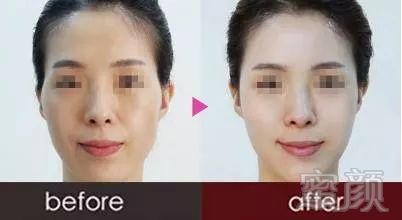 https://img.miyanlife.com/mnt/timg/190104/130Q23549-4.jpg
