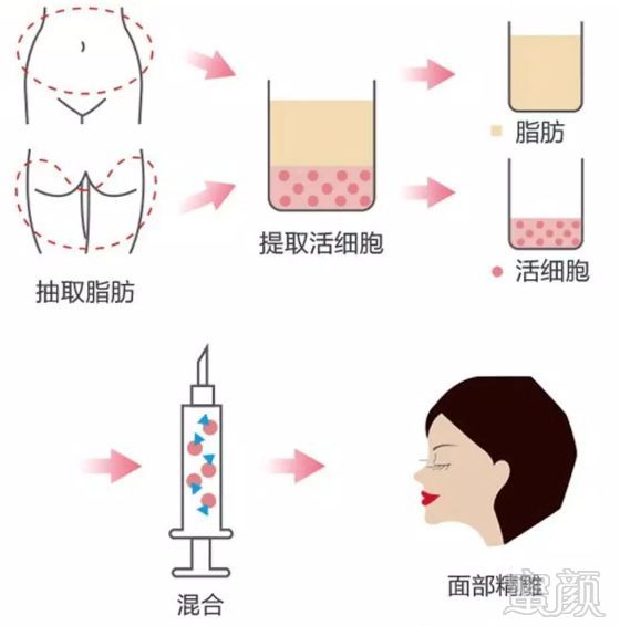 https://img.miyanlife.com/mnt/timg/190104/130Q23C6-2.jpg