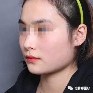 https://img.miyanlife.com/mnt/timg/190105/115332C61-0.jpg