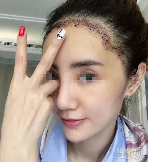 https://img.miyanlife.com/mnt/timg/190106/101Q960A-3.jpg