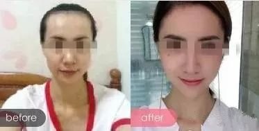 https://img.miyanlife.com/mnt/timg/190106/101QV450-0.jpg
