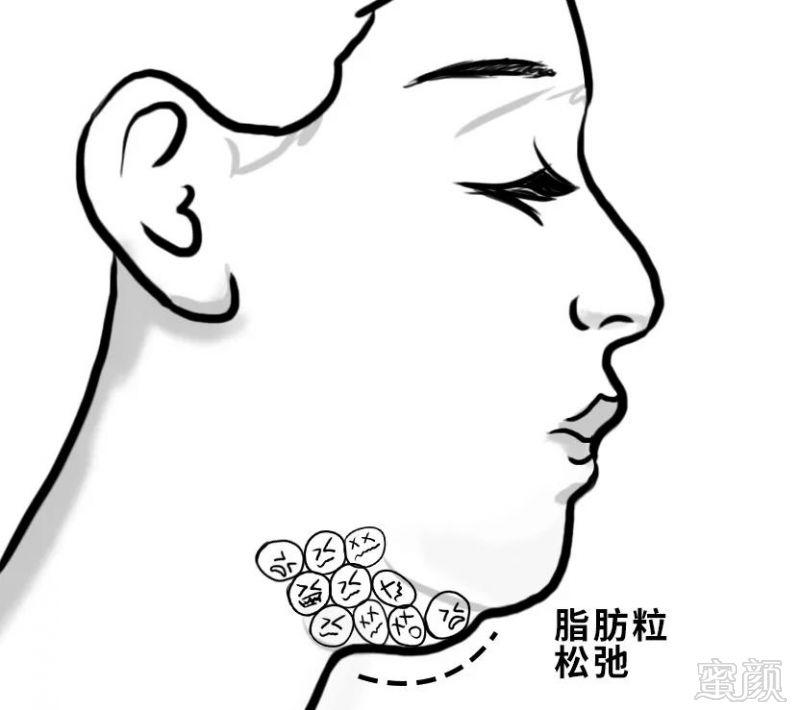 https://img.miyanlife.com/mnt/timg/190106/120P325V-2.jpg