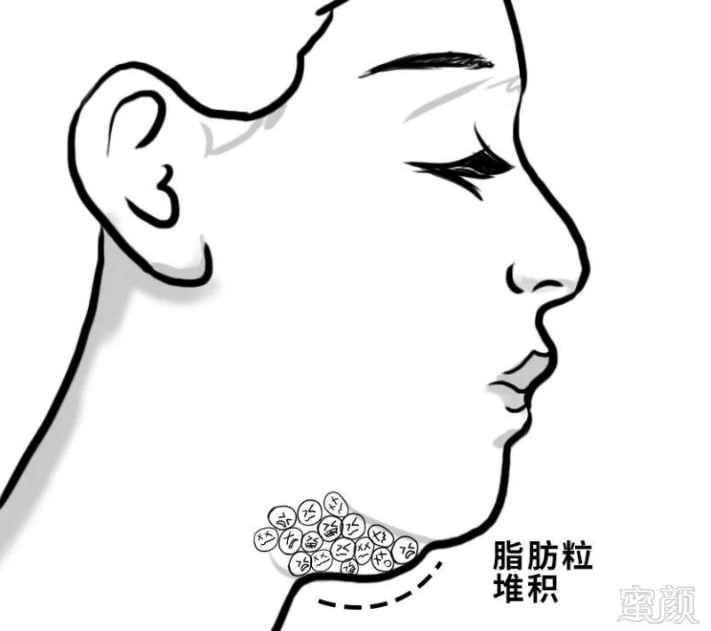 https://img.miyanlife.com/mnt/timg/190106/120P3I00-1.jpg