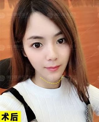 https://img.miyanlife.com/mnt/timg/190106/1213595I2-11.jpg