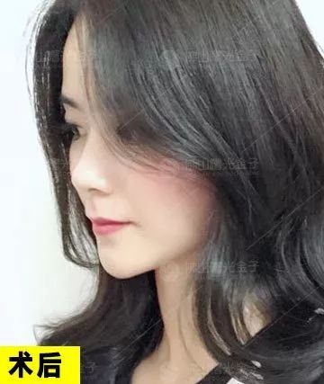 https://img.miyanlife.com/mnt/timg/190106/1213596154-13.jpg