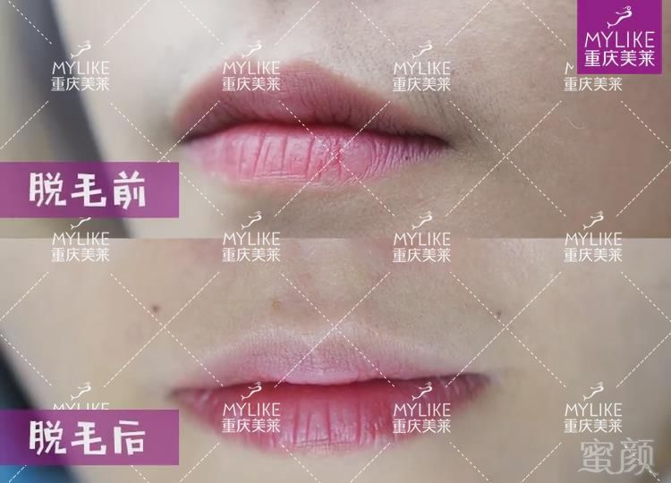 https://img.miyanlife.com/mnt/timg/190107/110F344Z-3.jpg