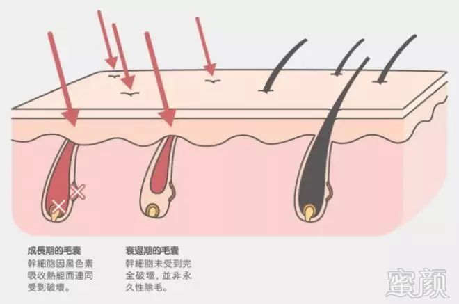 https://img.miyanlife.com/mnt/timg/190107/11160U0O-3.jpg