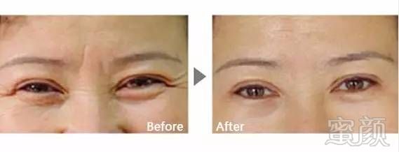 https://img.miyanlife.com/mnt/timg/190107/120I13M8-4.jpg