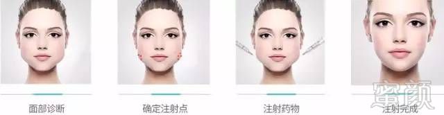 https://img.miyanlife.com/mnt/timg/190107/120I150a-6.jpg
